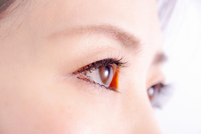  3. ビタミンE欠乏症