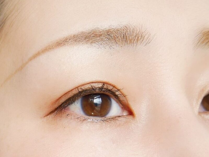 硝子体手術の成功率はどのくらい？手術の流れ・費用についても解説