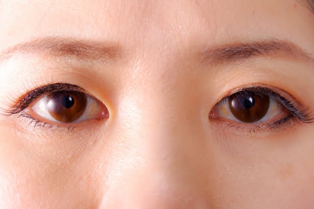 レーシックを「やらなきゃよかった」と後悔しないために知っておくべきこと